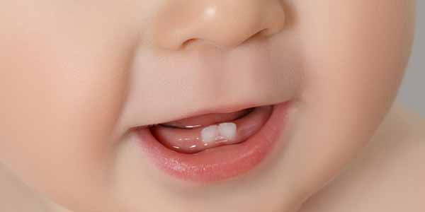 Denti neonato: quando spuntano e rimedi per alleviare il dolore