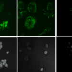 effetti delle nanoplastiche sulle ossa